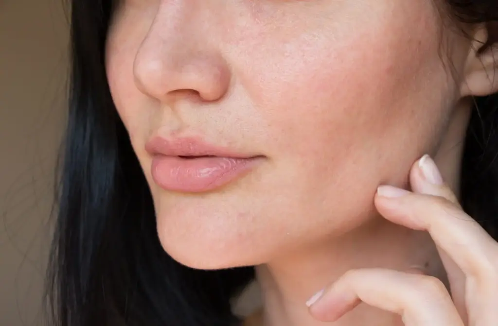 Does Kybella Really Work for a Double Chin What to Expect